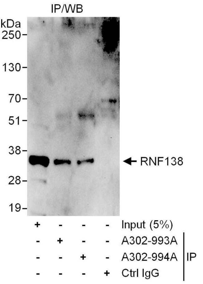 RNF138 Antibody in Immunoprecipitation (IP)