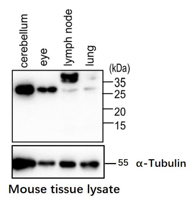 RNF138 Antibody in Western Blot (WB)