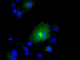 RNF144B Antibody in Immunocytochemistry (ICC/IF)