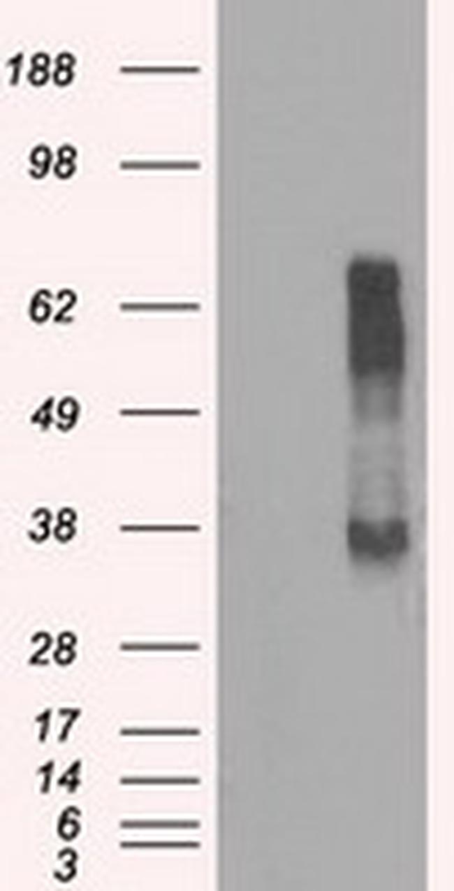 RNF144B Antibody in Western Blot (WB)