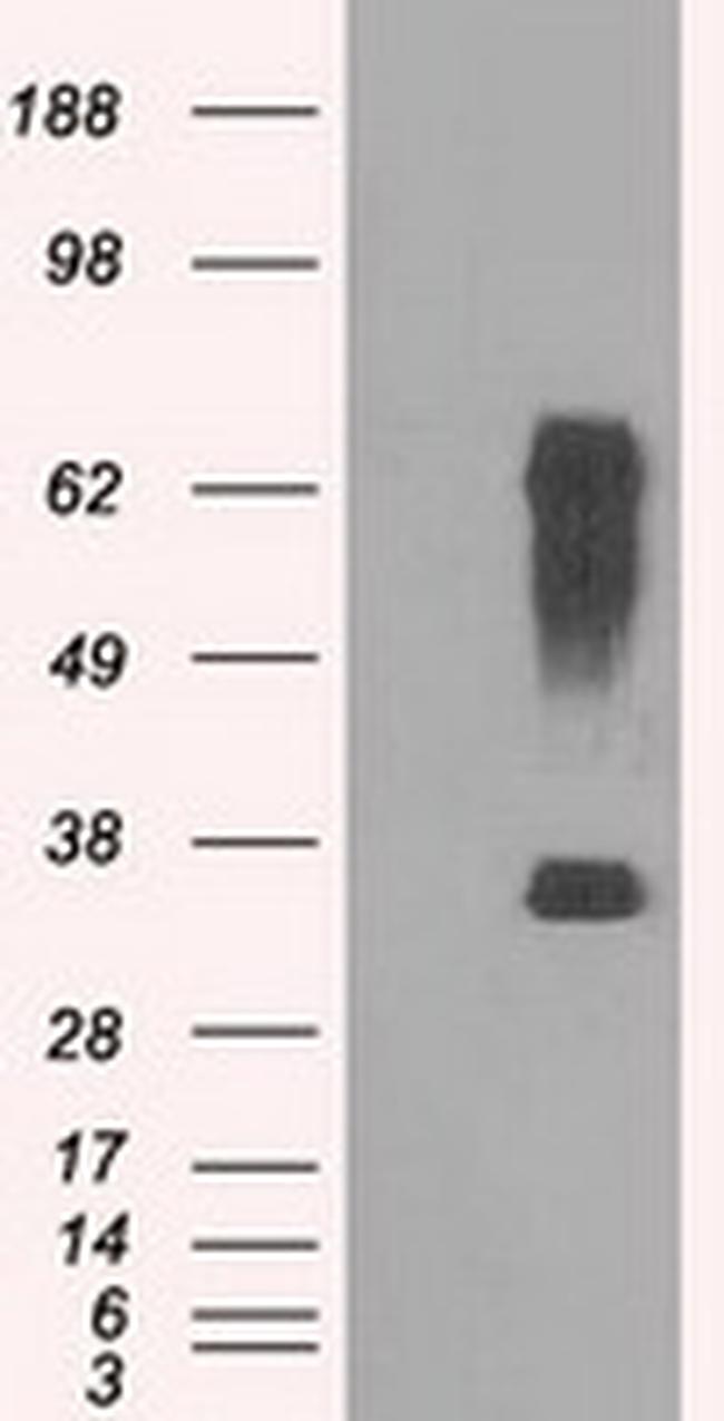 RNF144B Antibody in Western Blot (WB)