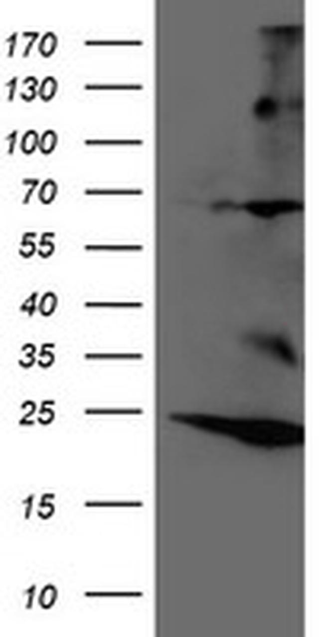 RNF144B Antibody in Western Blot (WB)