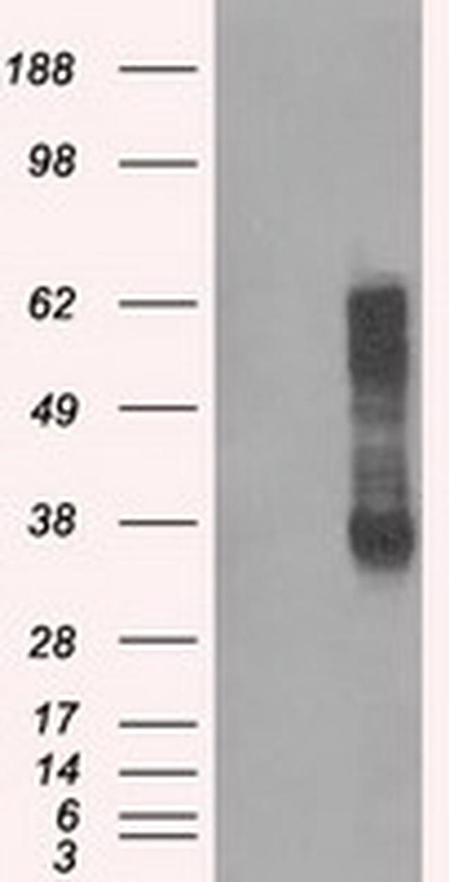 RNF144B Antibody in Western Blot (WB)