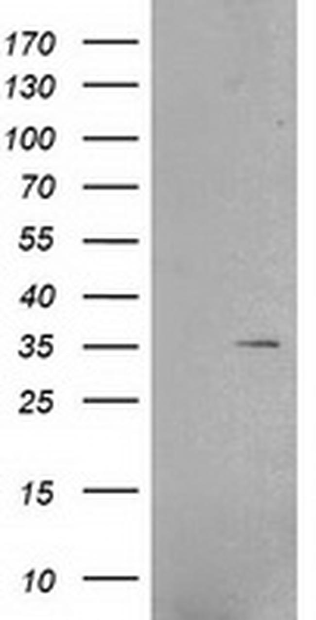 RNF144B Antibody in Western Blot (WB)