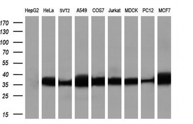 RNF144B Antibody in Western Blot (WB)