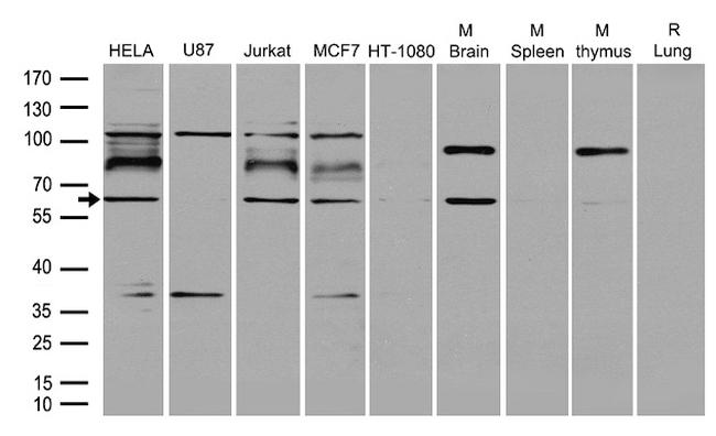 RNF168 Antibody in Western Blot (WB)