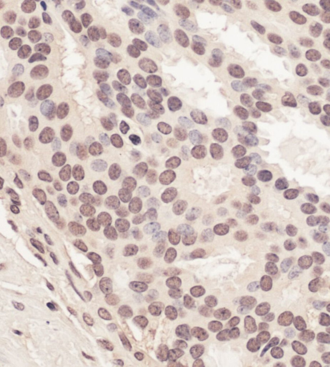 RNF2 Antibody in Immunohistochemistry (IHC)