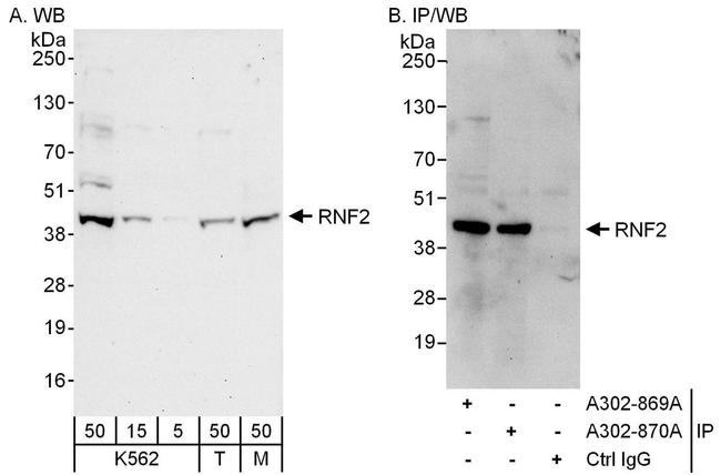 RNF2 Antibody in Western Blot (WB)