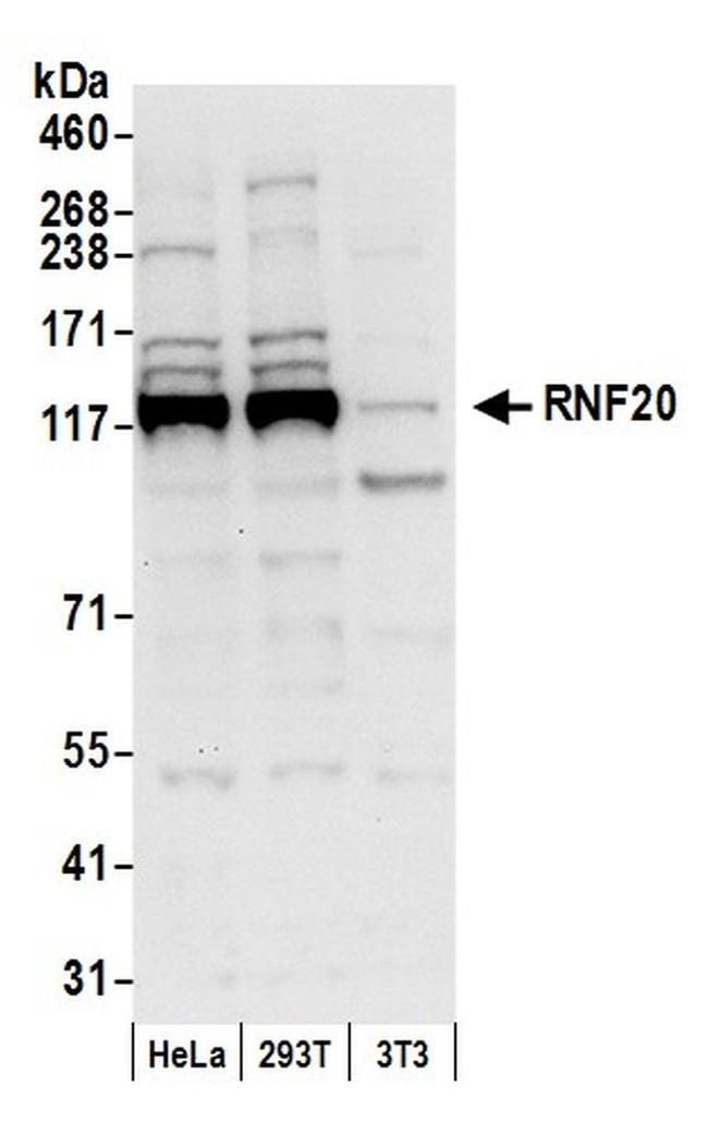 RNF20 Antibody in Western Blot (WB)