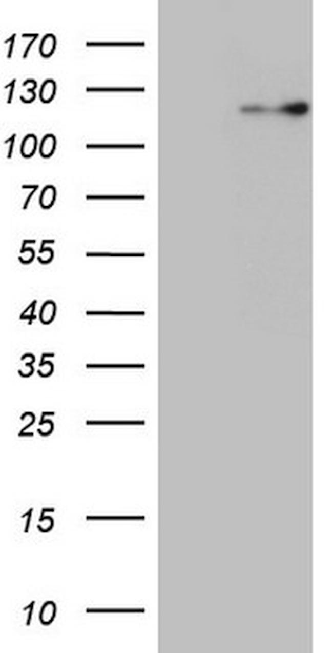 RNF20 Antibody in Western Blot (WB)