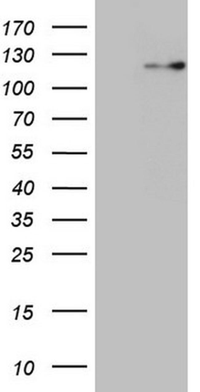 RNF20 Antibody in Western Blot (WB)