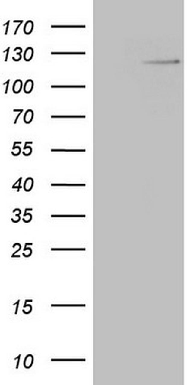 RNF20 Antibody in Western Blot (WB)