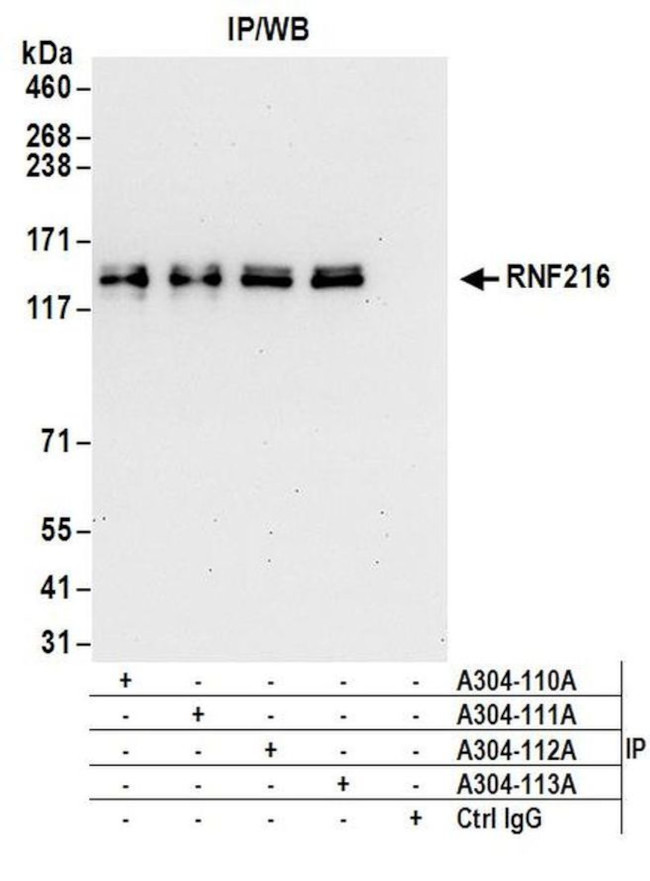 RNF216 Antibody in Immunoprecipitation (IP)