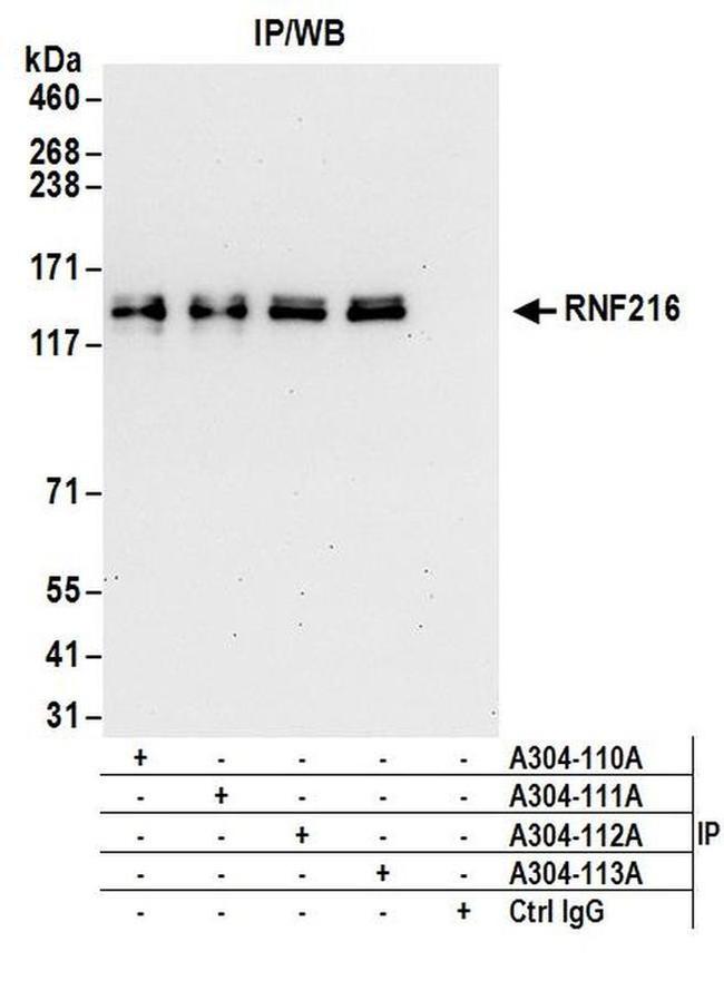 RNF216 Antibody in Western Blot (WB)