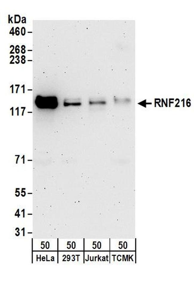 RNF216 Antibody in Western Blot (WB)