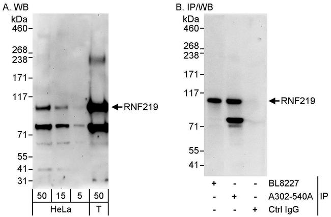 RNF219 Antibody in Western Blot (WB)