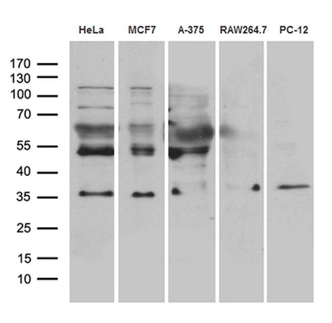 RNF4 Antibody in Western Blot (WB)