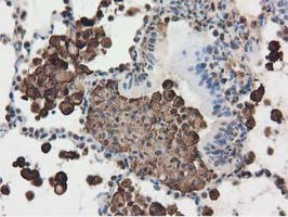 RNH1 Antibody in Immunohistochemistry (Paraffin) (IHC (P))