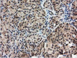 RNH1 Antibody in Immunohistochemistry (Paraffin) (IHC (P))