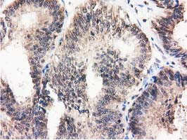 RNH1 Antibody in Immunohistochemistry (Paraffin) (IHC (P))