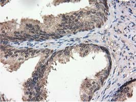 RNH1 Antibody in Immunohistochemistry (Paraffin) (IHC (P))