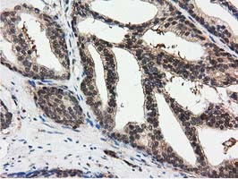 RNH1 Antibody in Immunohistochemistry (Paraffin) (IHC (P))