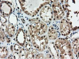 RNH1 Antibody in Immunohistochemistry (Paraffin) (IHC (P))