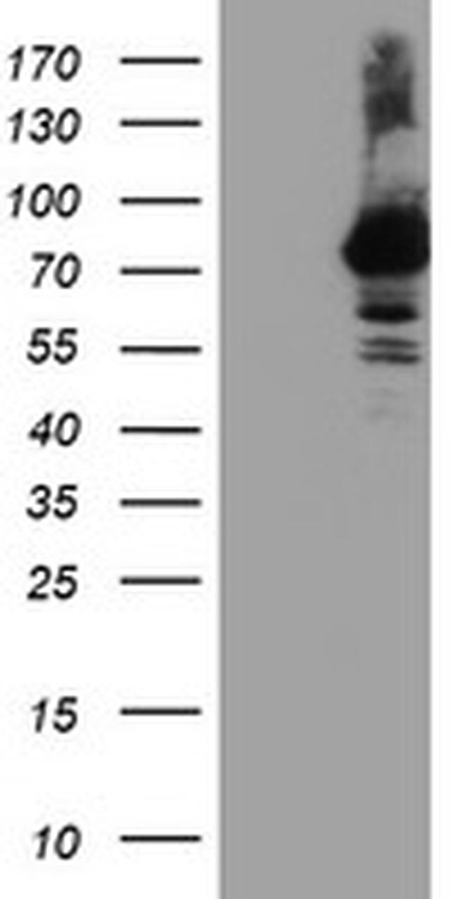 RNPEP Antibody in Western Blot (WB)