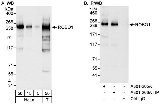 ROBO1 Antibody in Western Blot (WB)