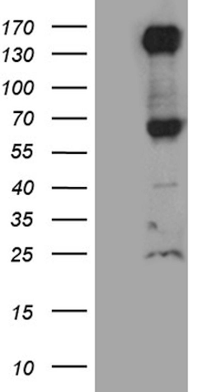 ROBO4 Antibody in Western Blot (WB)