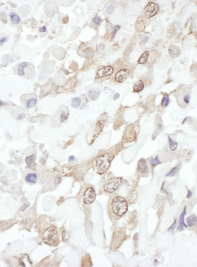 ROC1 Antibody in Immunohistochemistry (IHC)