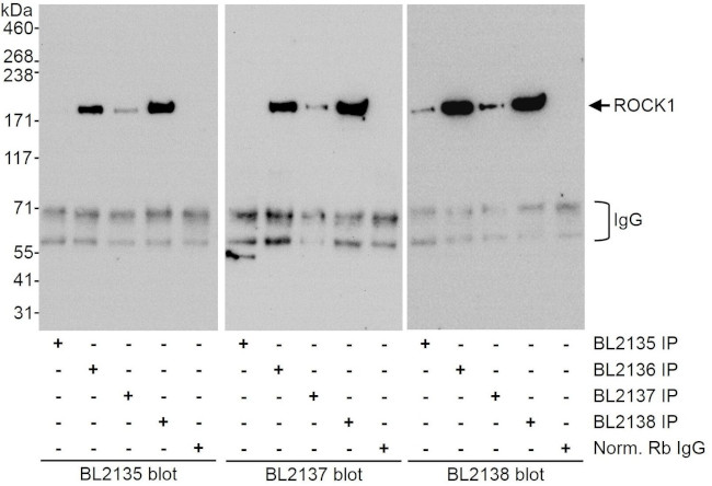 ROCK1 Antibody in Immunoprecipitation (IP)