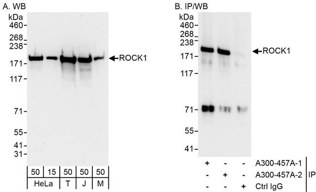 ROCK1 Antibody in Western Blot (WB)