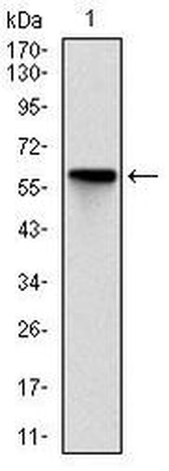 ROCK1 Antibody in Western Blot (WB)