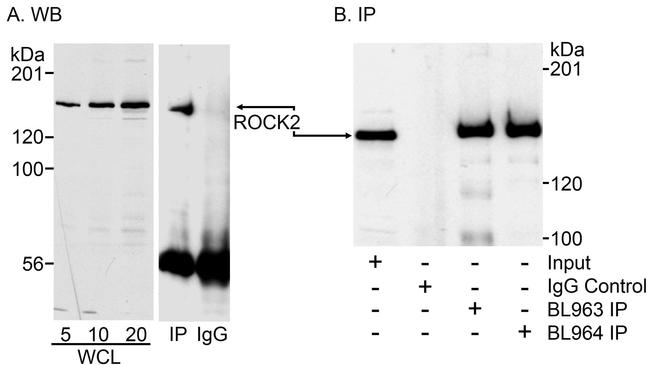 ROCK2 Antibody in Western Blot (WB)