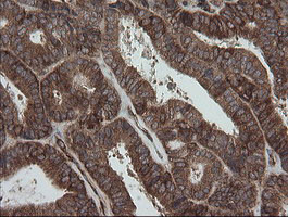 ROMO1 Antibody in Immunohistochemistry (Paraffin) (IHC (P))