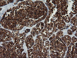 ROMO1 Antibody in Immunohistochemistry (Paraffin) (IHC (P))