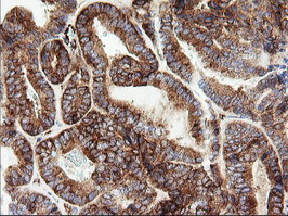 ROMO1 Antibody in Immunohistochemistry (Paraffin) (IHC (P))