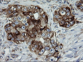 ROMO1 Antibody in Immunohistochemistry (Paraffin) (IHC (P))