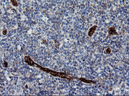 ROMO1 Antibody in Immunohistochemistry (Paraffin) (IHC (P))