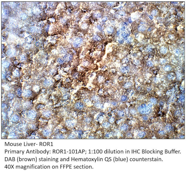 ROR1 Antibody in Immunohistochemistry (IHC)