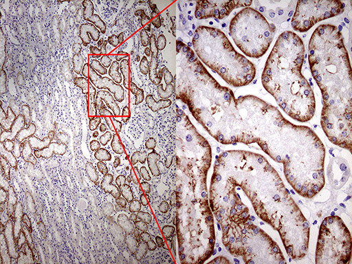 ROR2 Antibody in Immunohistochemistry (Paraffin) (IHC (P))