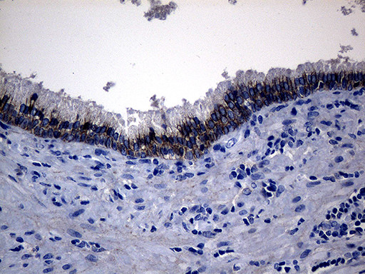 ROR2 Antibody in Immunohistochemistry (Paraffin) (IHC (P))