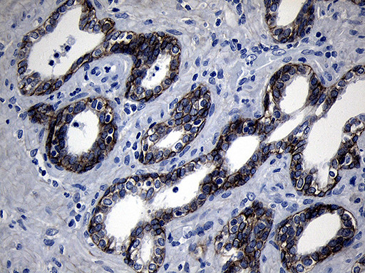 ROR2 Antibody in Immunohistochemistry (Paraffin) (IHC (P))