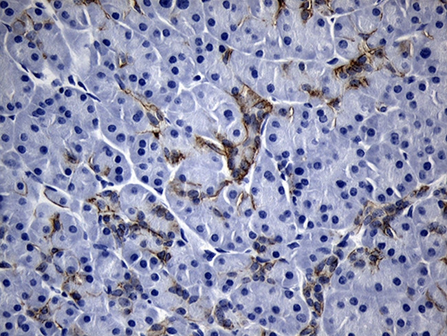 ROR2 Antibody in Immunohistochemistry (Paraffin) (IHC (P))