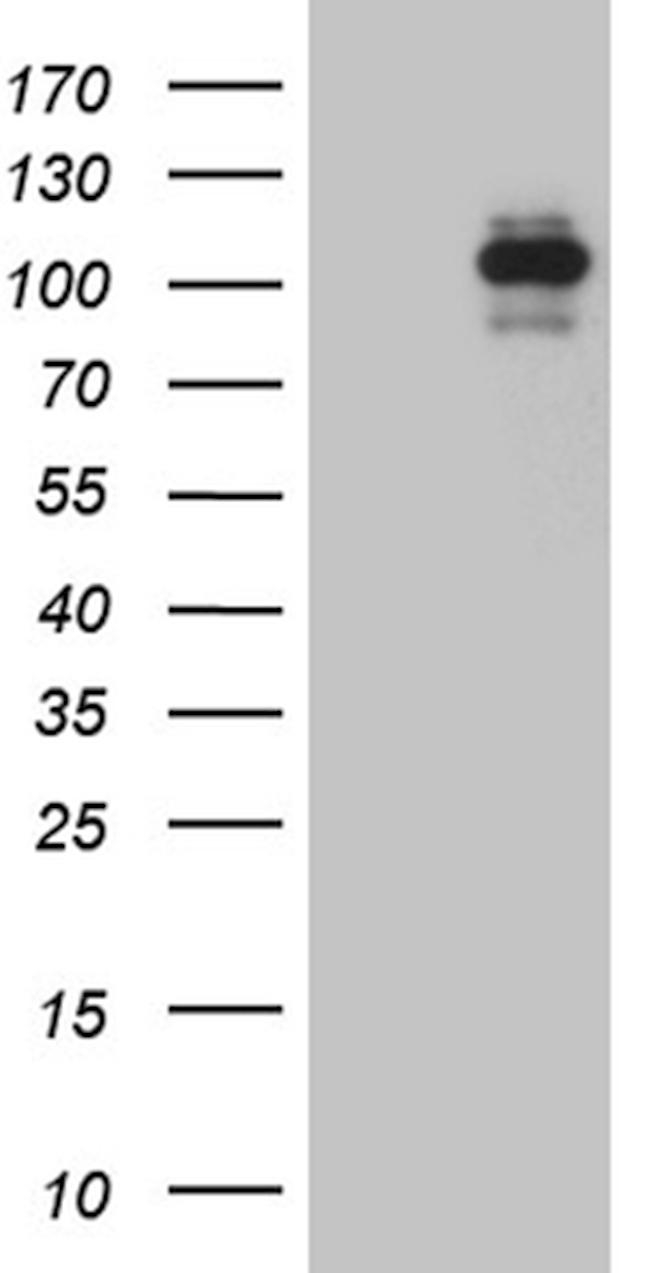 ROR2 Antibody in Western Blot (WB)