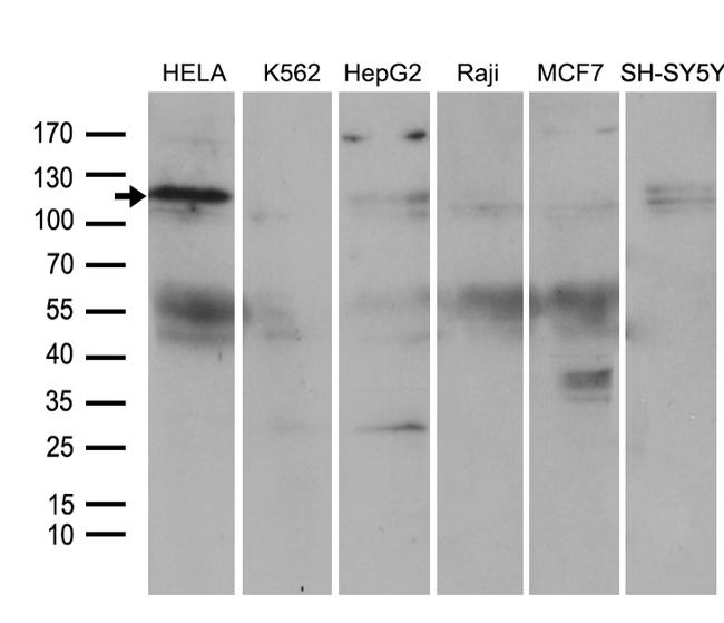 ROR2 Antibody in Western Blot (WB)