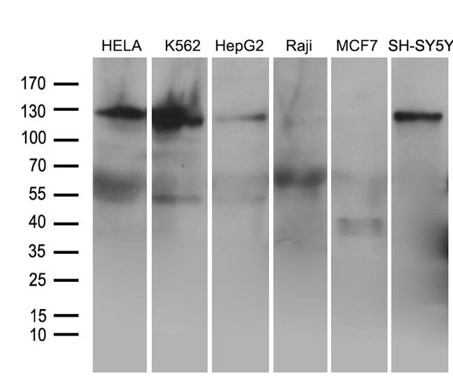 ROR2 Antibody in Western Blot (WB)