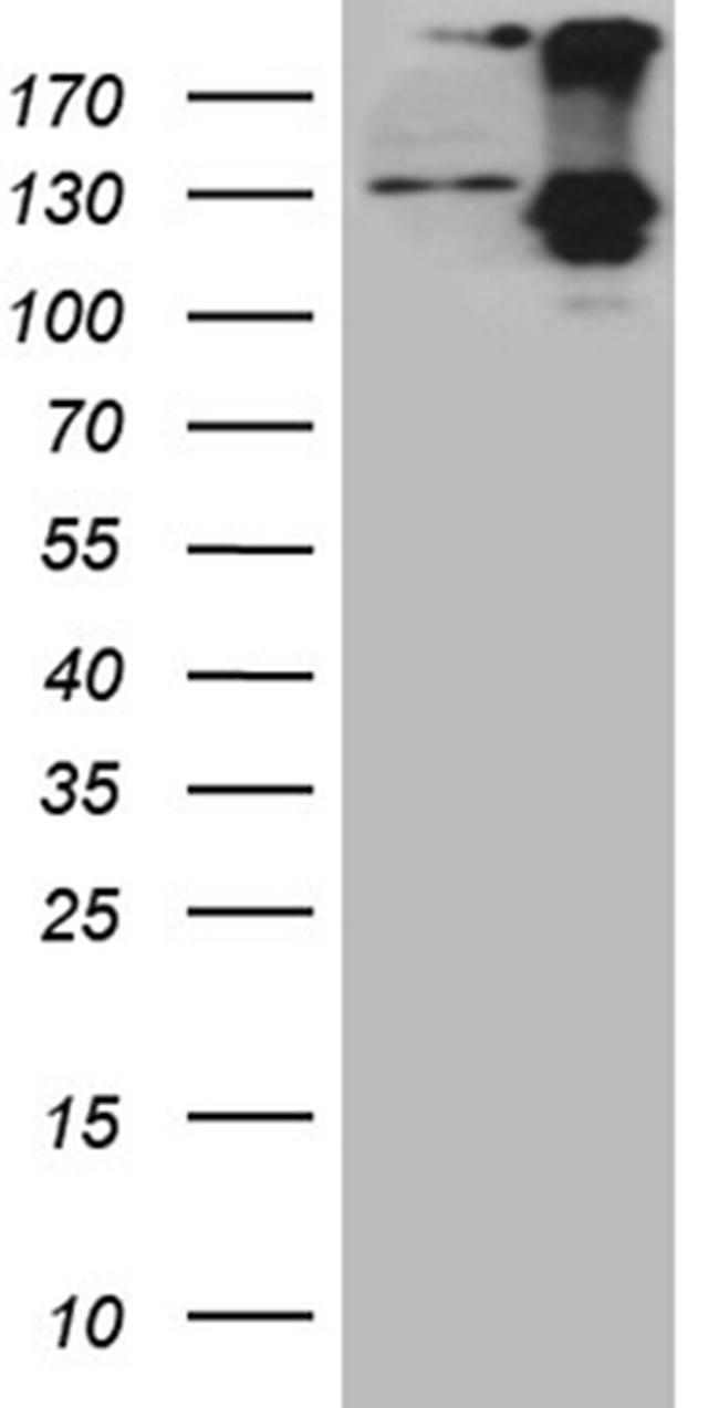 ROR2 Antibody in Western Blot (WB)