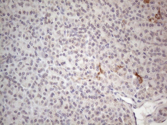 RORB Antibody in Immunohistochemistry (Paraffin) (IHC (P))